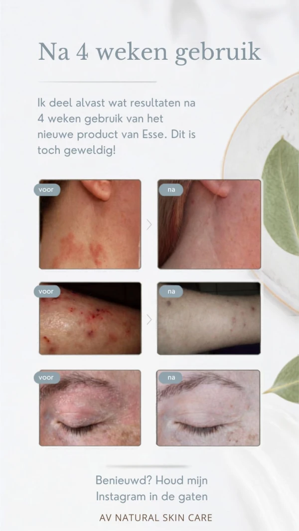 Barriere Rescue 80ml tube - Foto 2
